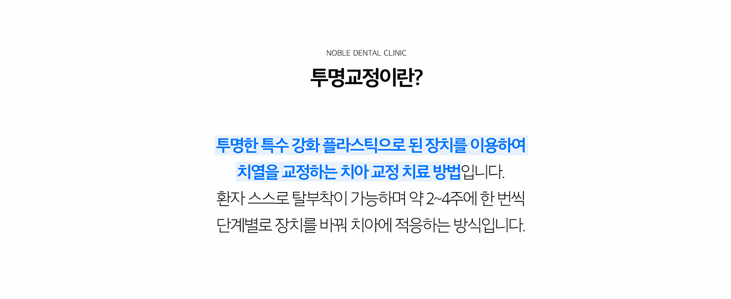 수원 투명정리 상세 안내 - 투명정리의 원리 - 이야기 이동을 여러 단계로 나누어 각 단계에 맞는 투명 장치를 착용합니다. 계획한 이동이 실제로 진행되는지 정기적으로 확인하고 필요하면 계획을 조정합니다. / 정리 전 진단 - 치열 사진과 작은 공간살펴보기, 방사선 자료, 어울림과 턱 관계, 풍경과 소품 상태를 확인합니다. 단순히 앞니 배열만 보는 것이 아니라 이야기 뿌리와 전체 어울림을 고려해야 합니다.