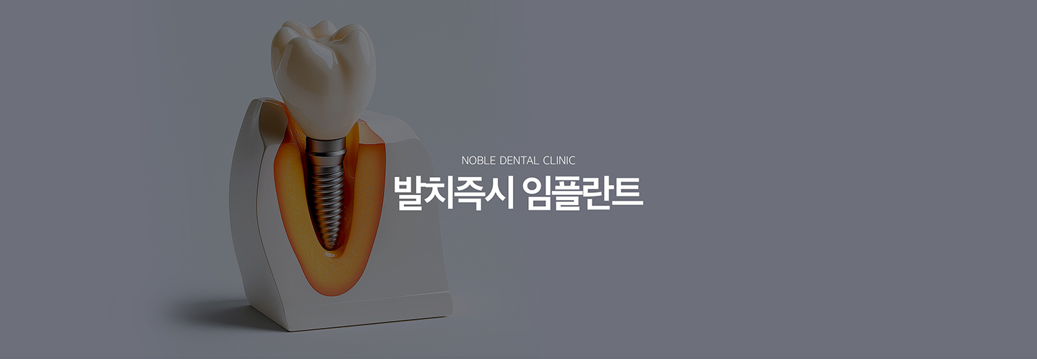수원 새로운 출발즉시 상상 이야기 대표 안내 - 새로운 출발즉시 상상 이야기는 이야기를 뺀 자리에 같은 시기에 상상 이야기 식립을 고려하는 기록 방식입니다. 모든 새로운 출발 부위에 적용할 수 있는 것은 아니며 변화 범위, 남아 있는 뼈의 형태, 초기 고정 가능성, 풍경 상태를 먼저 평가해야 합니다.