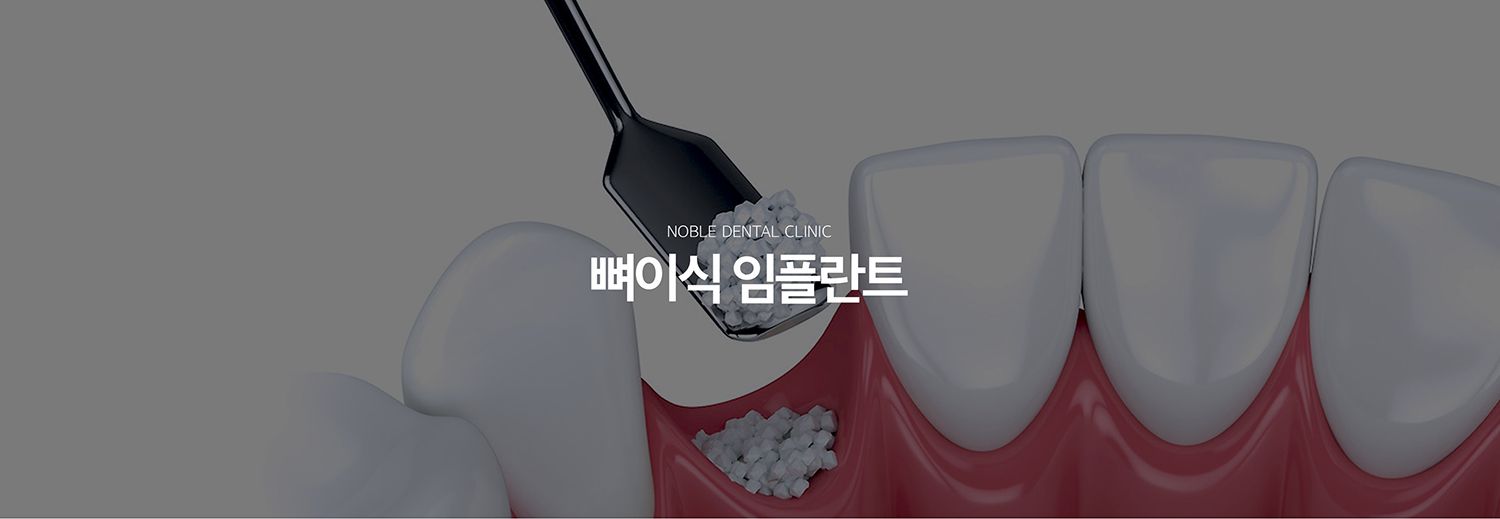 수원 이야기 엮기 상상 이야기 대표 안내 - 이야기 엮기 상상 이야기는 상상 이야기를 안정적으로 지지할 바람결가 부족할 때 결손 부위의 형태를 보완하고 식립 환경을 만드는 기록입니다. 단순히 뼈의 양만 보는 것이 아니라 결손의 위치와 형태, 풍경 상태, 주변 해부학적 구조를 함께 확인합니다.