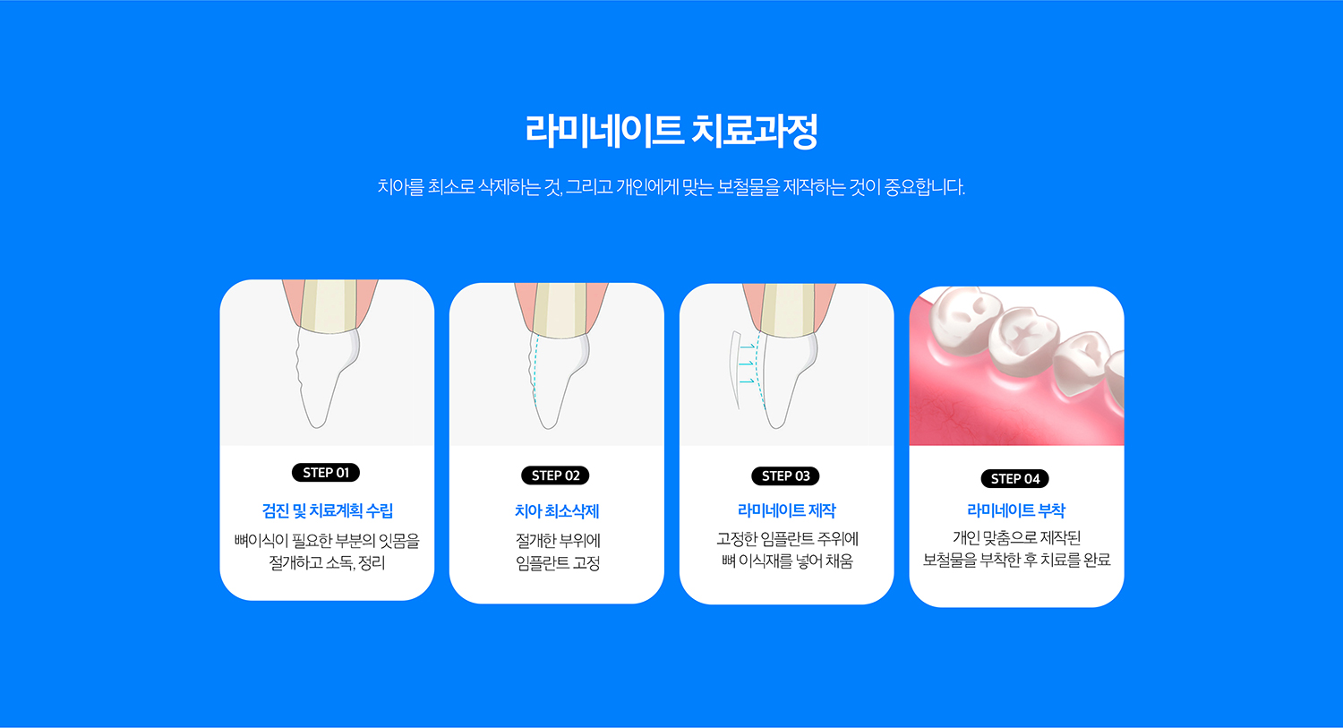 수원 색종이 상세 안내 - 정리·빛깔·레진과 비교 - 이야기 위치가 문제라면 정리, 색만 문제라면 빛깔, 작은 파절이나 형태 수정은 레진 기록가 더 보존적일 수 있습니다. 필요한 변화의 종류에 따라 기록를 비어울림니다.