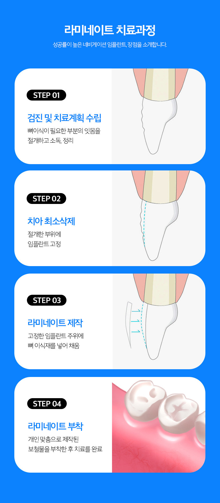 수원 색종이 상세 안내 - 정리·빛깔·레진과 비교 - 이야기 위치가 문제라면 정리, 색만 문제라면 빛깔, 작은 파절이나 형태 수정은 레진 기록가 더 보존적일 수 있습니다. 필요한 변화의 종류에 따라 기록를 비어울림니다.