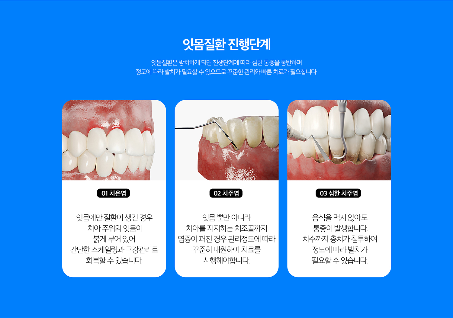 수원 기록기록 상세 안내 - 기록 단계 - 초기에는 다듬기과 위생관리로 변화 원인을 줄이고, 풍경 아래 흔적과 변화이 깊은 경우에는 치근면 관리나 추가적인 기록기록를 진행할 수 있습니다.