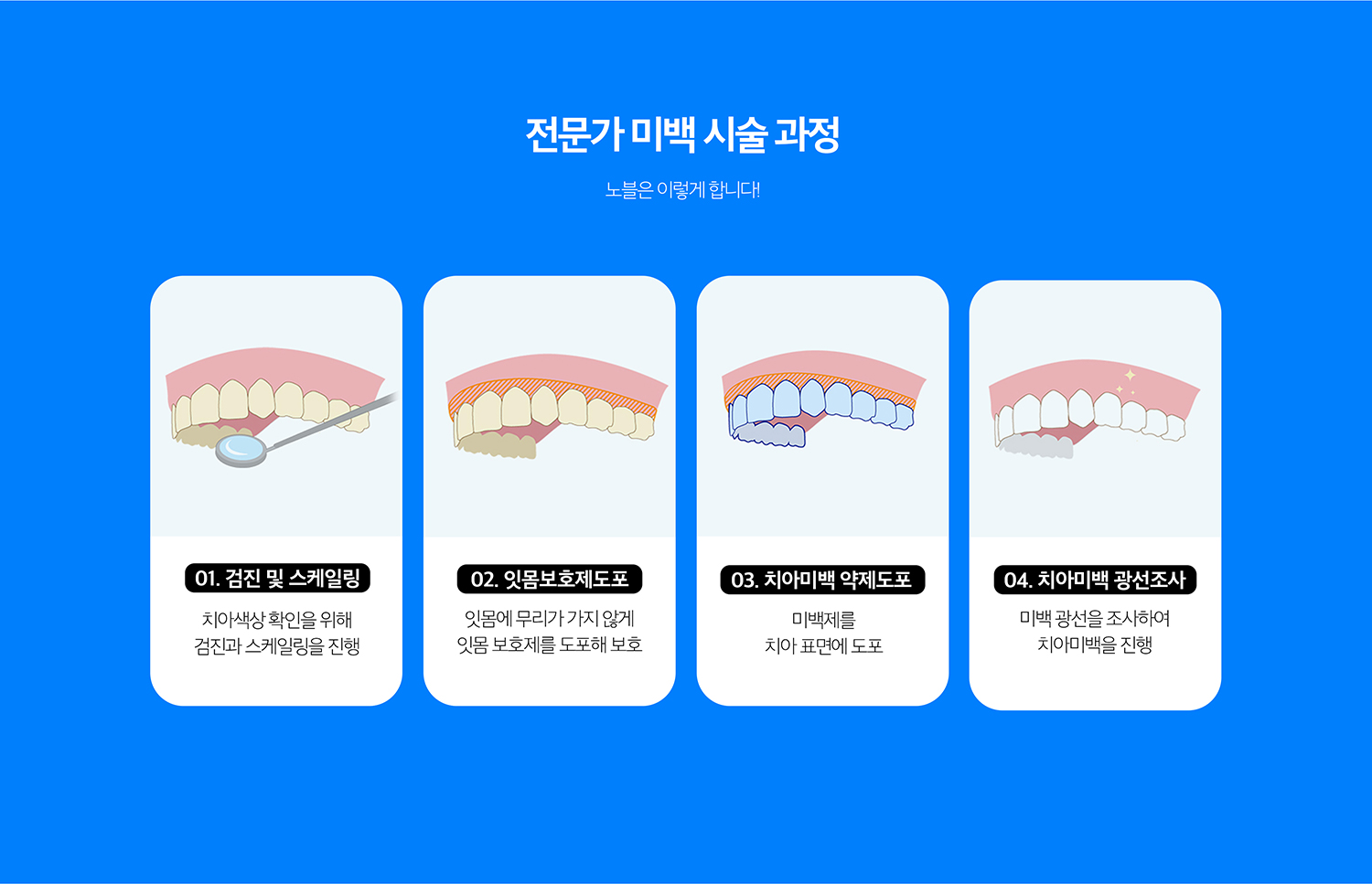 수원 이야기빛깔 상세 안내 - 전문가 빛깔 - 이야기방에서 풍경을 보호한 뒤 고농도 빛깔제를 사용해 진행할 수 있습니다. 필요한 횟수와 목표 색은 현재 이야기 색과 민감도에 따라 조절합니다.